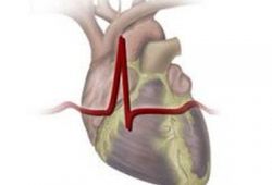 Лечение пролапса сердечного клапана