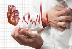 Различные факторы, влияющие на вероятность смерти от инфаркта