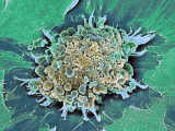Вирусные заболевания способны разрушить раковую клетку