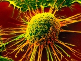 Медики научились лечить рак на 100 процентов