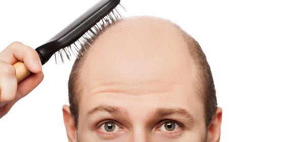 Причины выпадения волос и медицинские советы